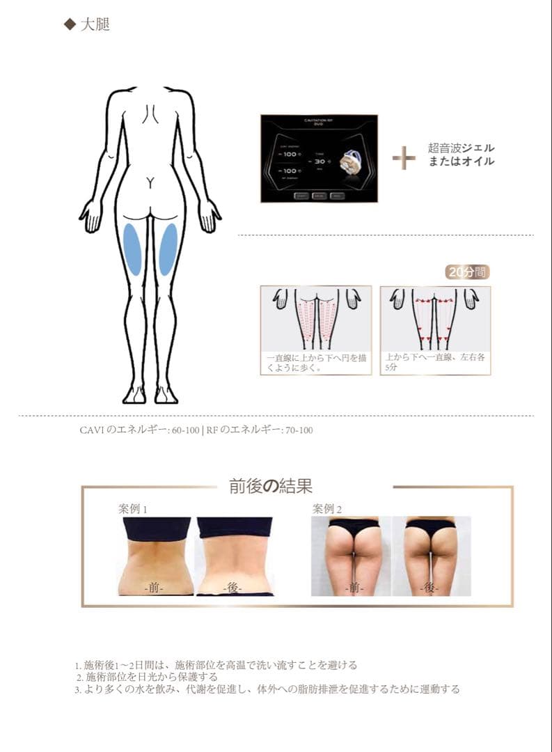 業務用キャビテーション
