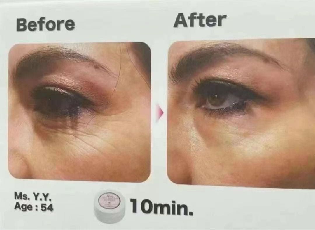 HITOKI ゴールドフレンチアイマスク 60枚入り*2個セット