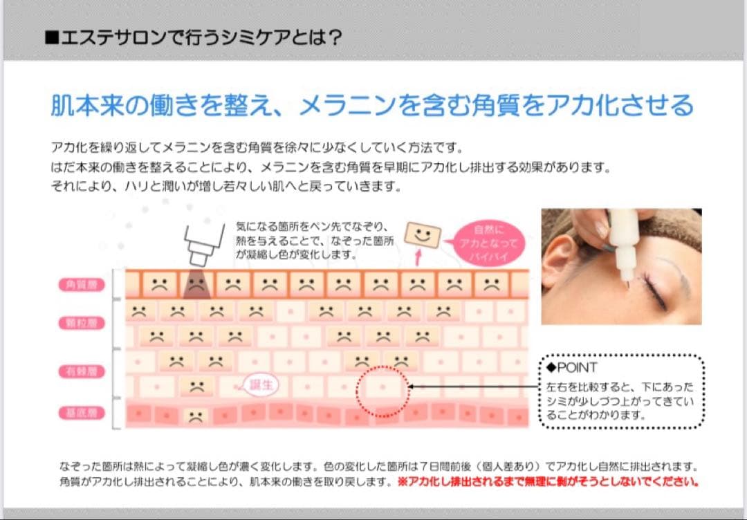 新品★送料無料★シミケア機器★タッチパネル式★簡単♪業務用・ホームケア使用可能★