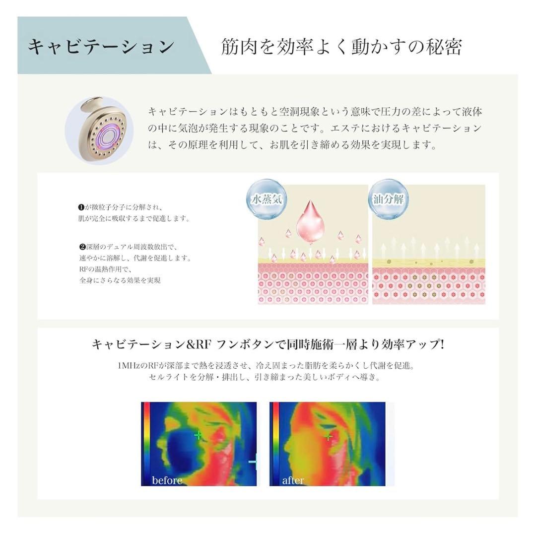 Yete キャビテーション EMS トータルケア　光美肌・ダイエット器具