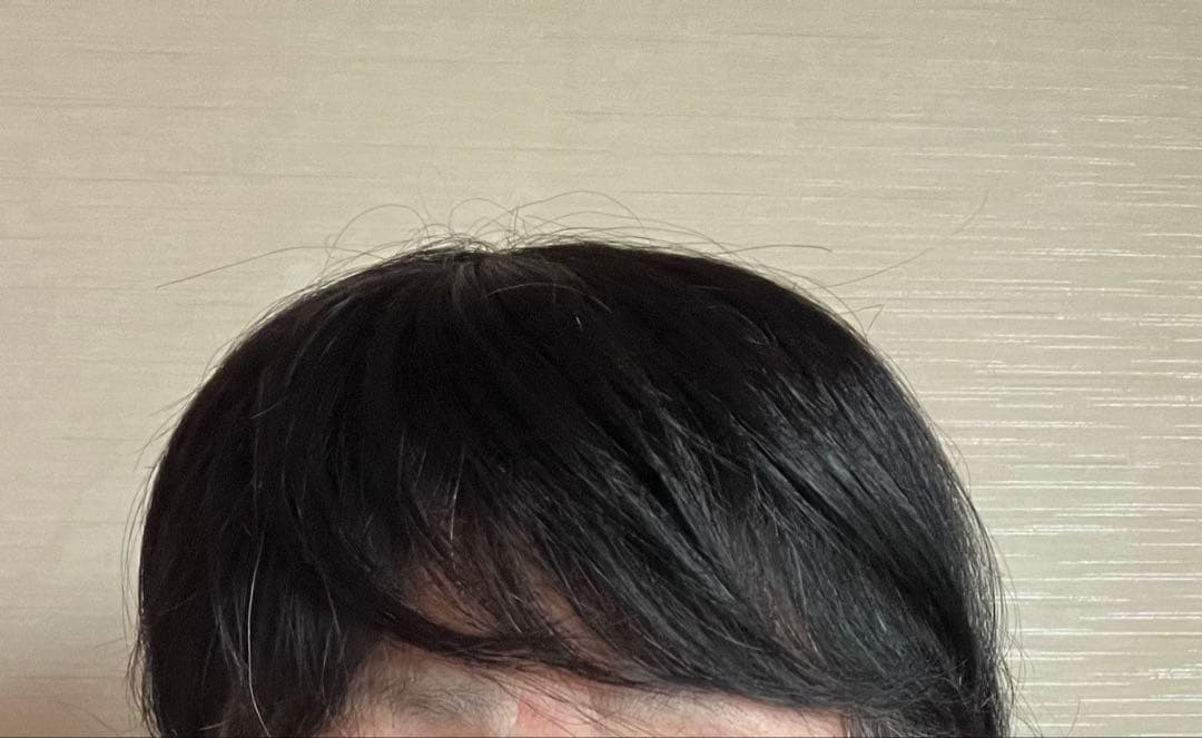 WIG YUKI ウィッグユキ/エアーすけすけピース/Ｍサイズ/人毛ミックス