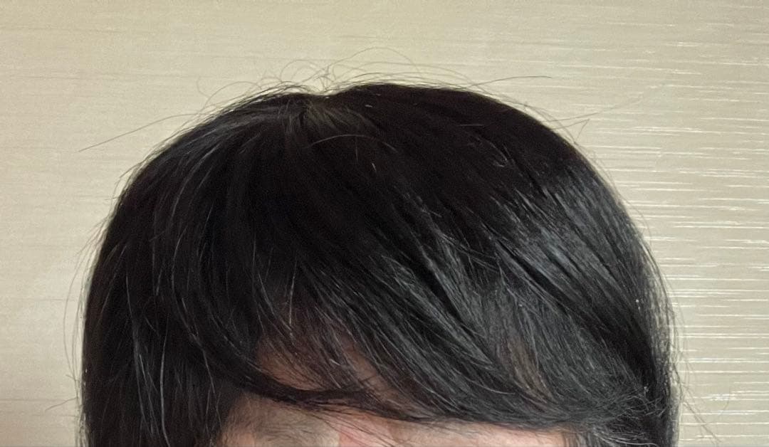 WIG YUKI ウィッグユキ/エアーすけすけピース/Ｍサイズ/人毛ミックス