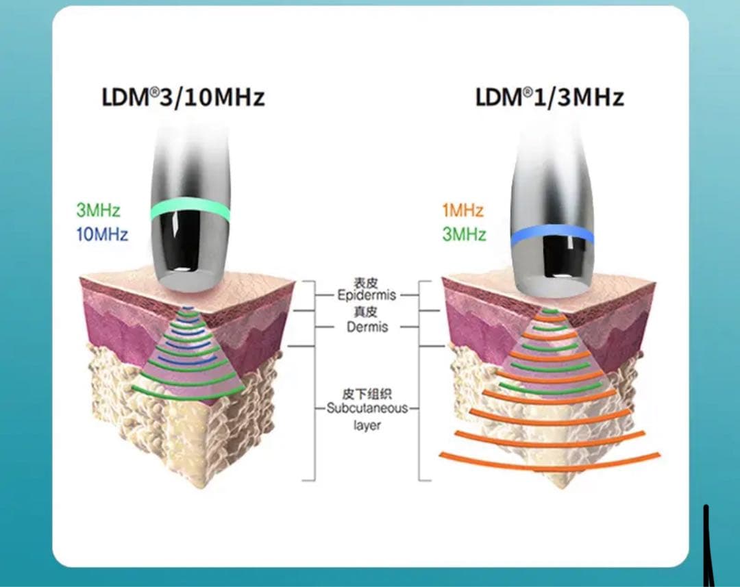 LDM水玉SANO 超音波 美容機器リフトアップマシン