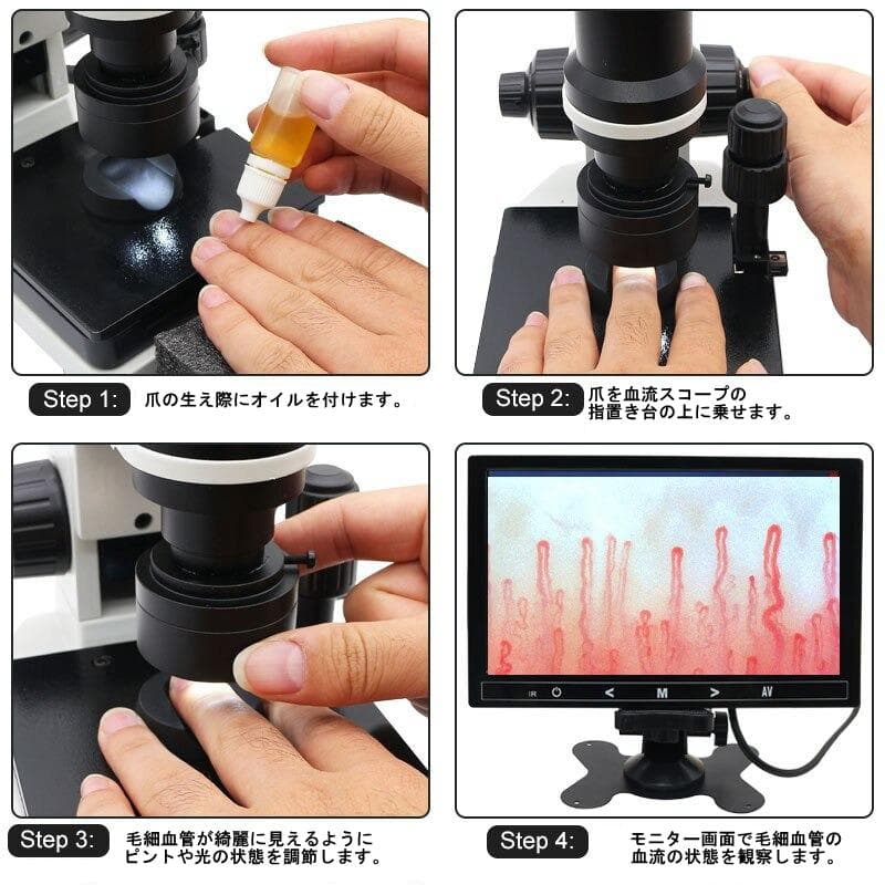 【新品・送料込】高倍率 血流スコープ　９インチモニター付！　テレビ接続も可能！