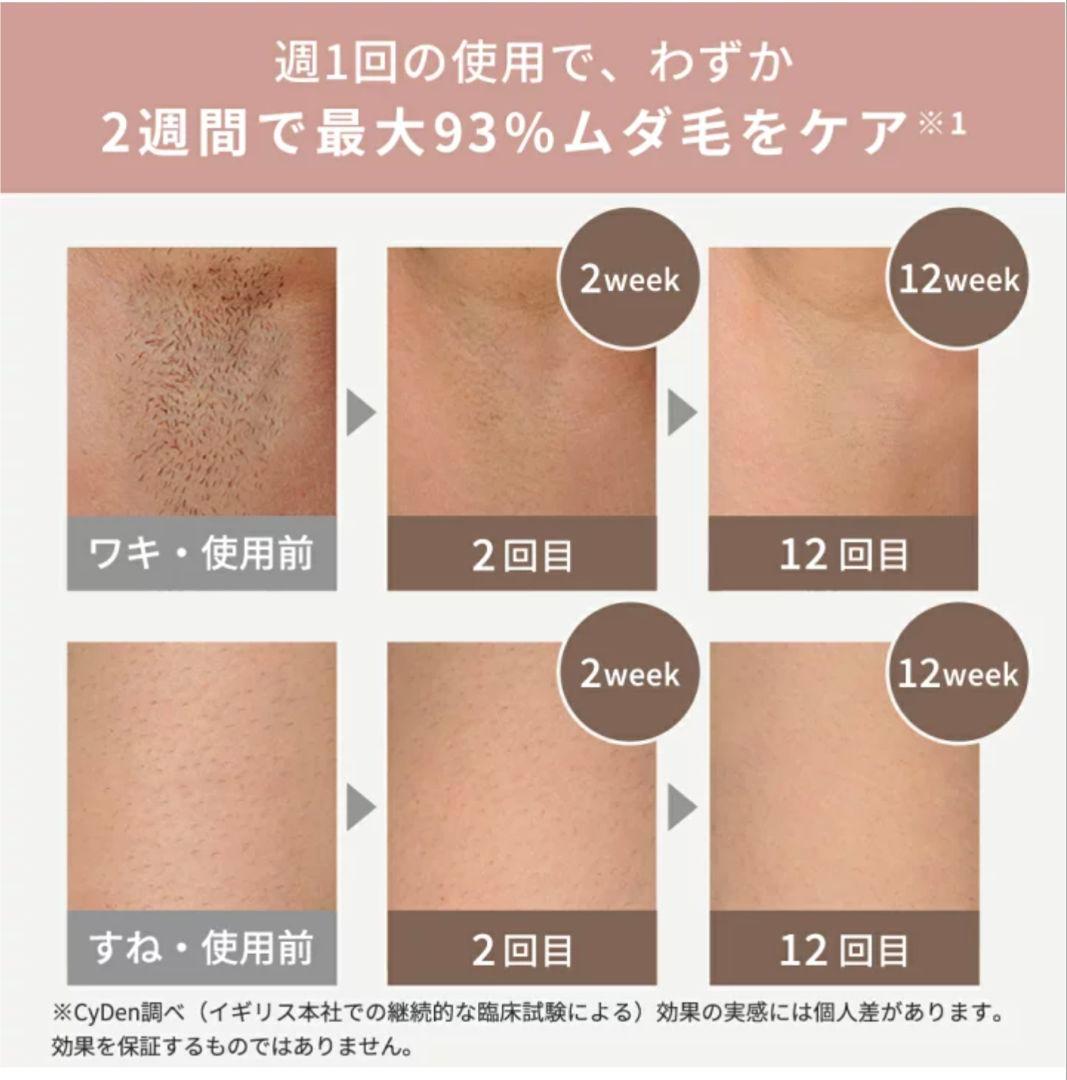 SMOOTHSKIN　Pure Switch 脱毛器　スペシャルキッド
