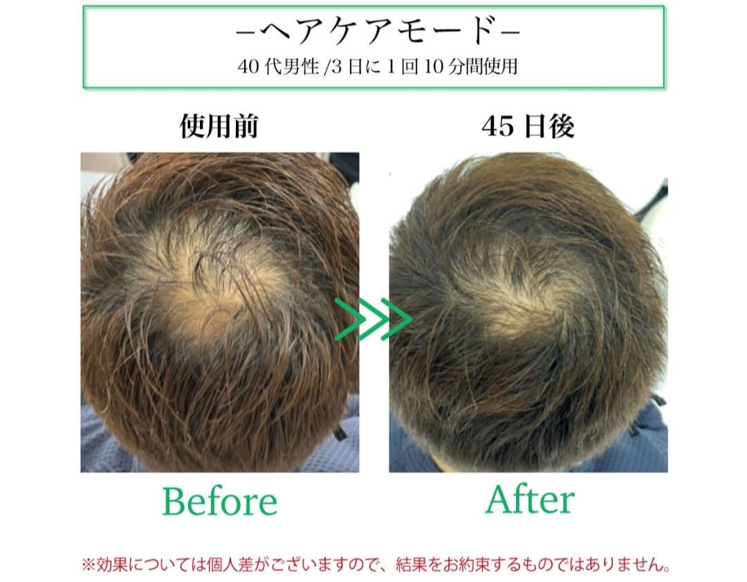 レディッチトリプロ【美品】♡美肌＊美髪＊オーラルケア