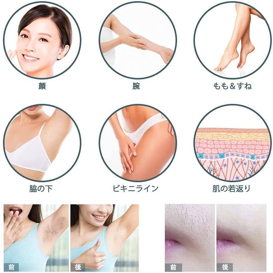 脱毛器 ipl光脱毛器 メンズレディース兼用 家庭用脱毛器 全身対応 5段階調整