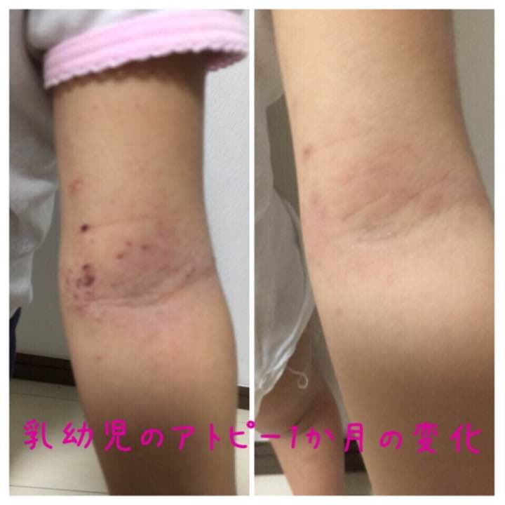 水素風呂 新型！