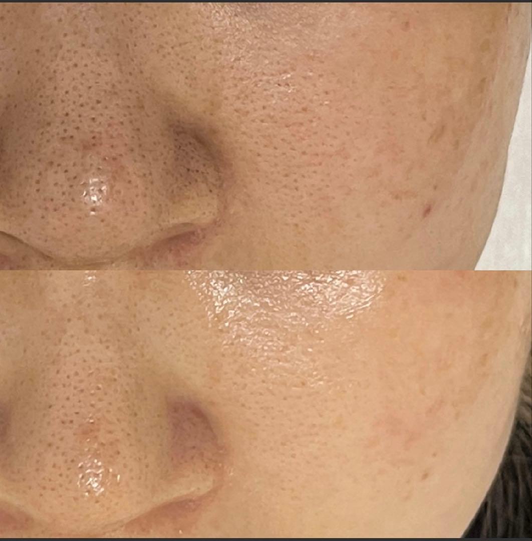 saya　セラピール2回分+マスク2枚