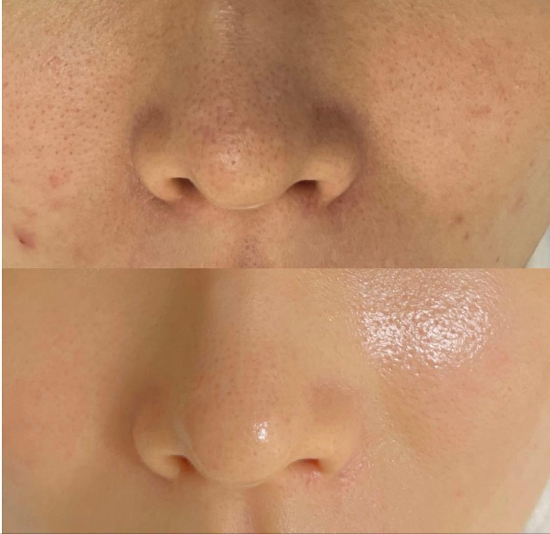 saya　セラピール2回分+マスク2枚