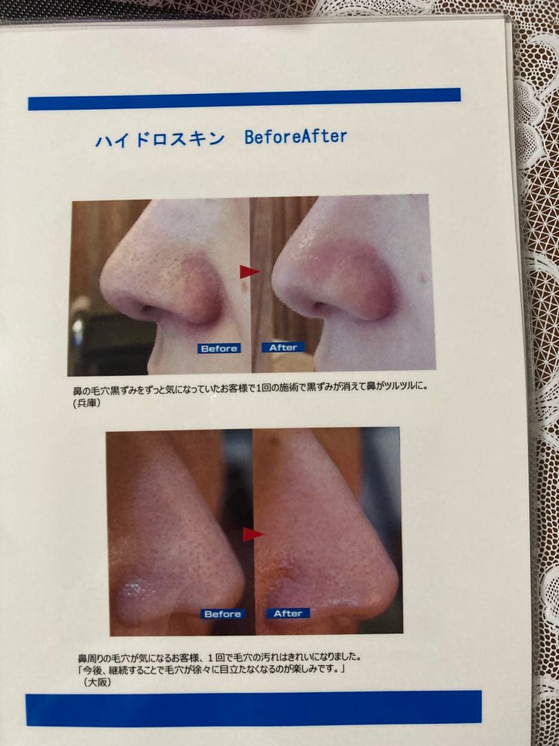 AQUA ELLA. 美顔器 エッセンス付き