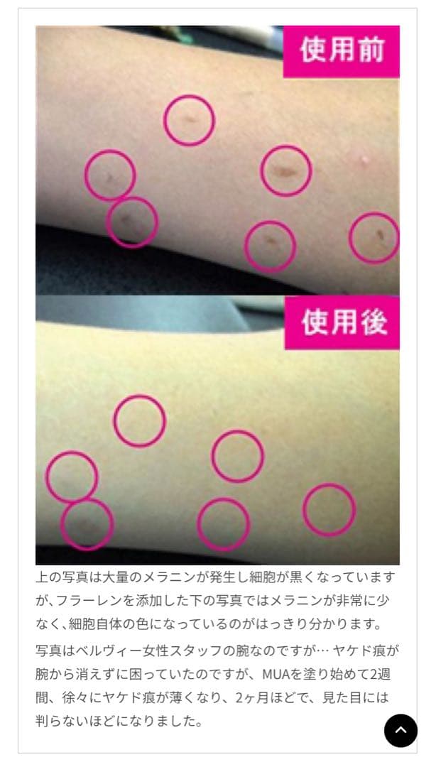 新品・未使用　Belle Vie ベルヴィー MUA しみ専用美白ジェル