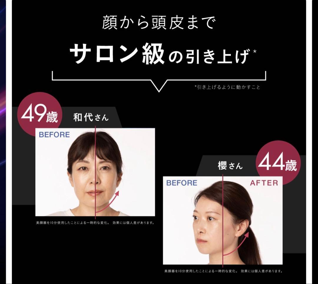 エレキブラシプラス　電気ブラシ　ミッキー限定デザイン　スカルプセラム付き