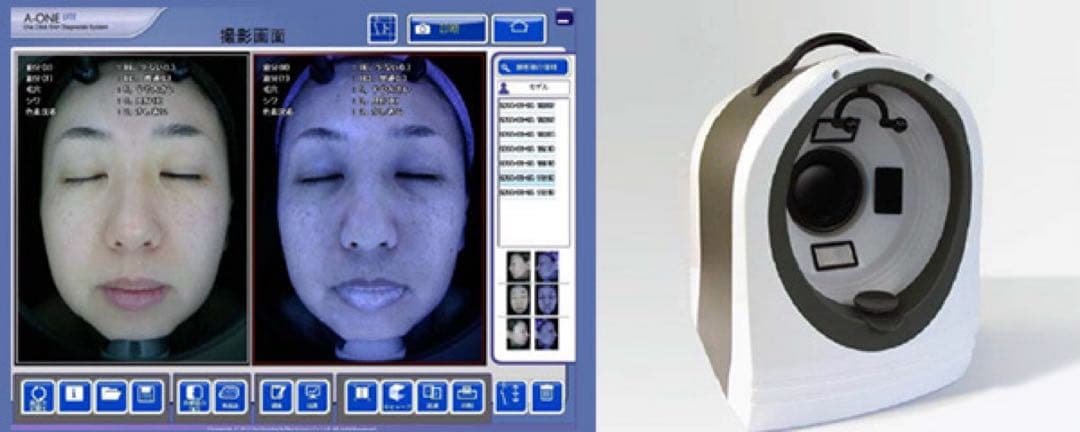 肌診断機　A-ONE パソコン付き