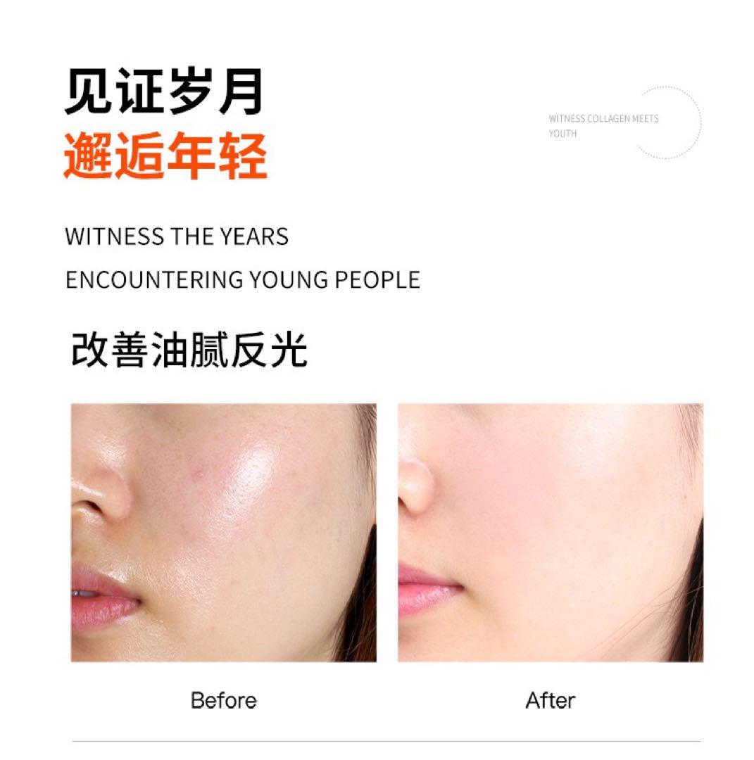 水玉リフティング LDM SONOと同等マシン 韓国肌管理