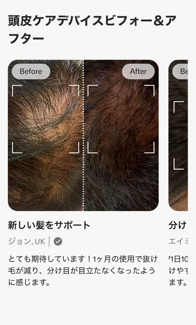 【週末セール1/12まで】カレントボディ SKIN LED 頭皮ケアデバイス