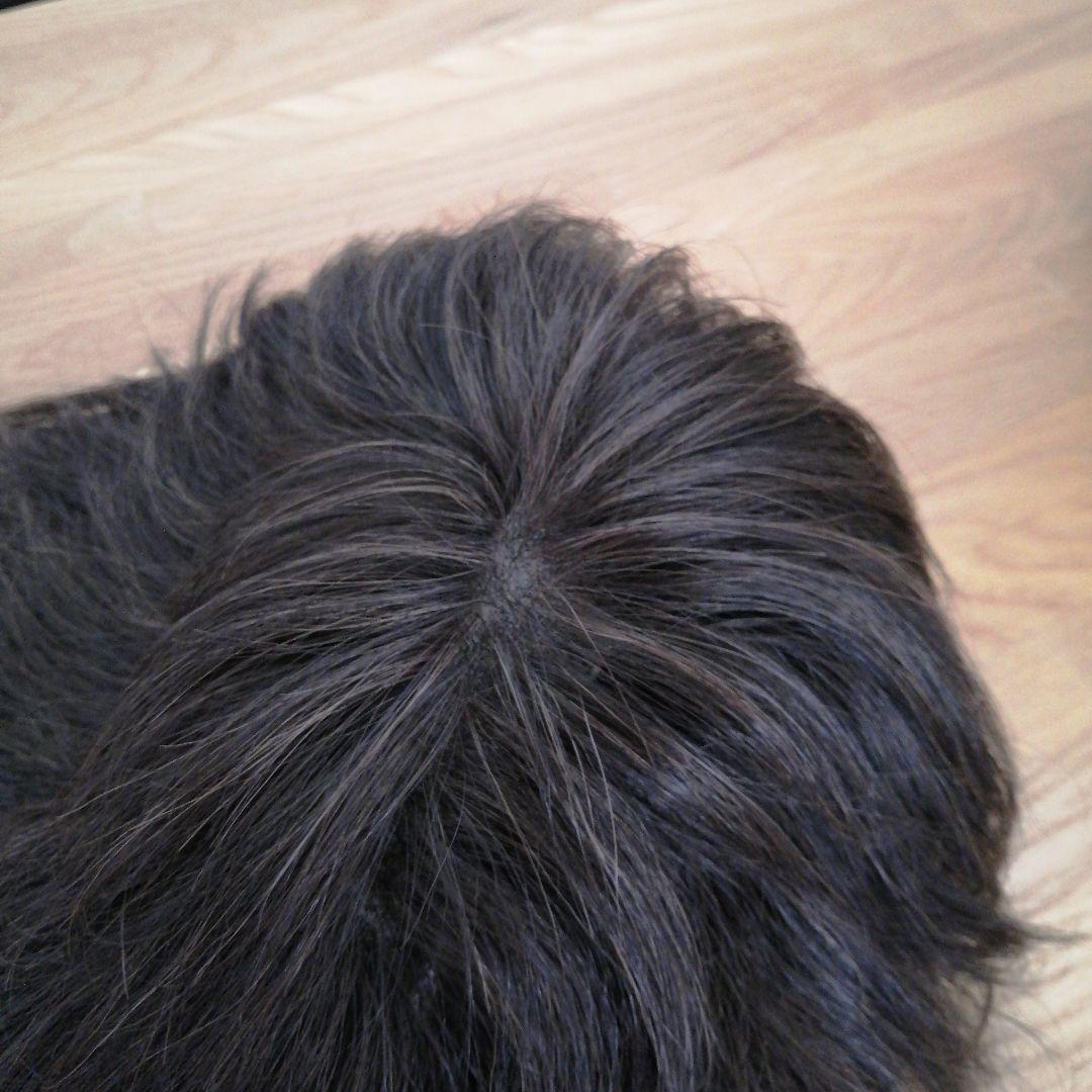 医療用スヴェンソンウィッグ人毛ミックス人工皮膚付きショートブラウン