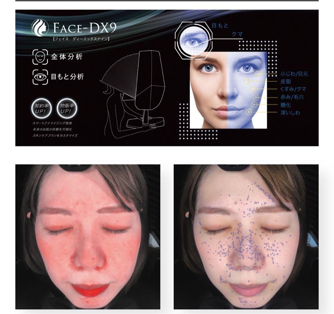 FACE-DX9 肌診断機
