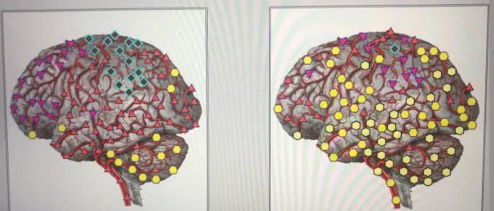 期間限定セール★波動測定器18D NLS メタトロン ニュースキャンヒーリング