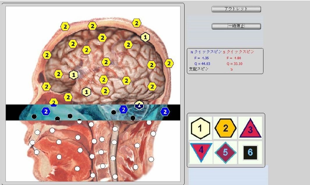 期間限定セール★波動測定器18D NLS メタトロン ニュースキャンヒーリング