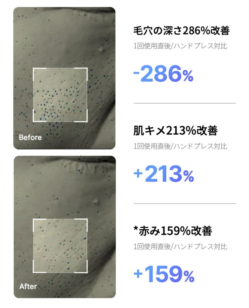 medicube AGE-Rブースタープロミニ