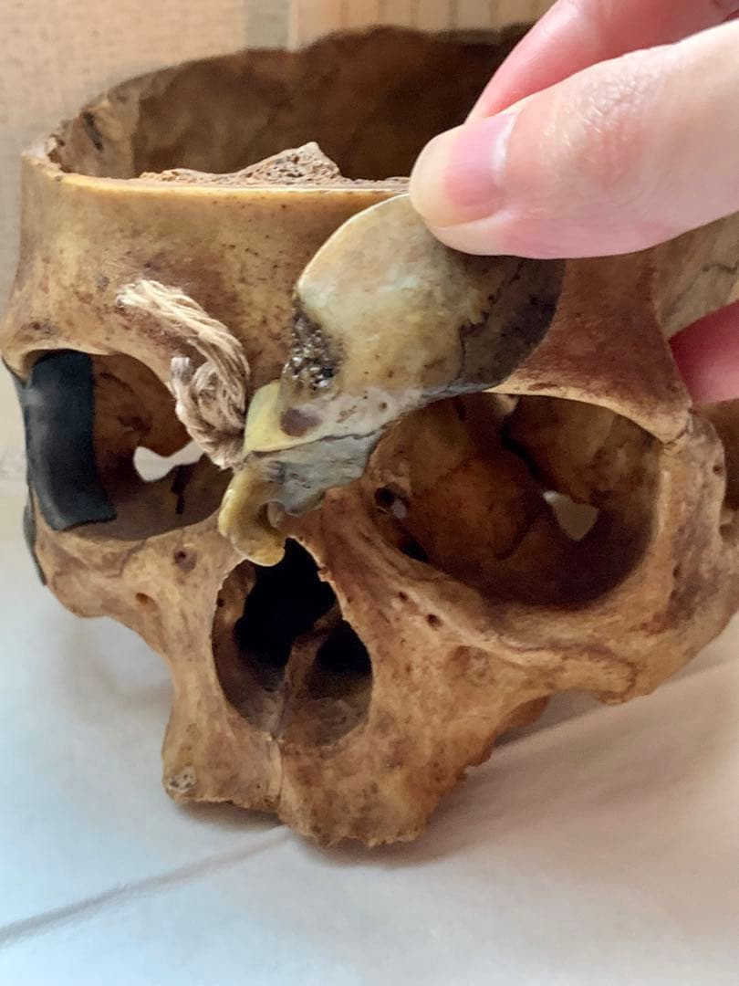 呪物　カパラ　天珠　チベット　カパーラ　頭蓋骨　根付　クマントーン　プラクルアン