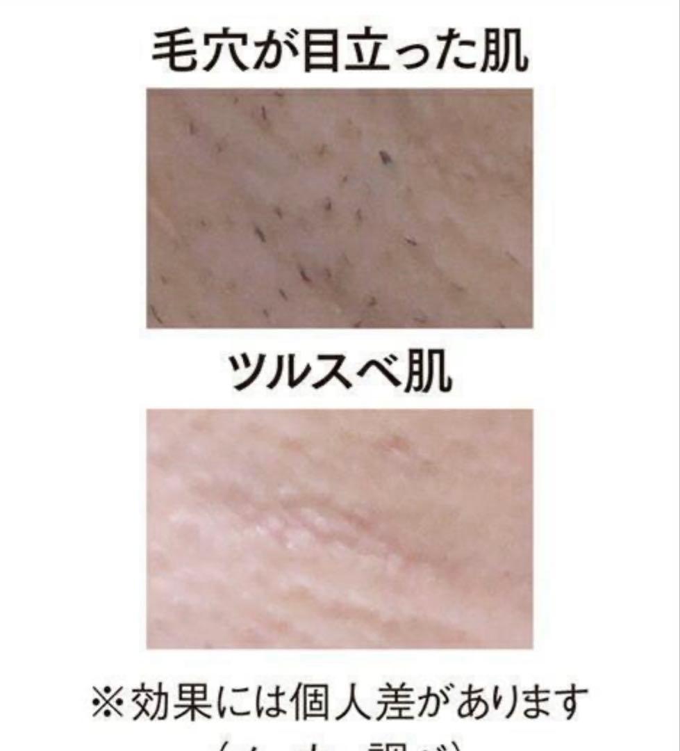 OMNI クールフラッシュボーテ 脱毛器 家庭用 OM-FM03NE