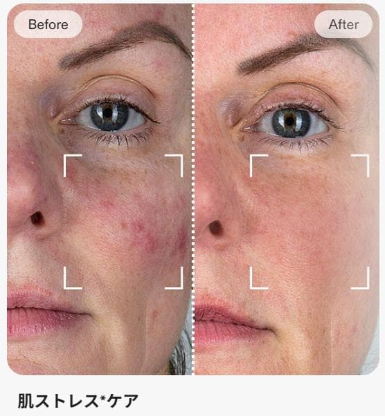 【未使用Currentbody Skin LED 4イン1 マスク＋マスク5枚