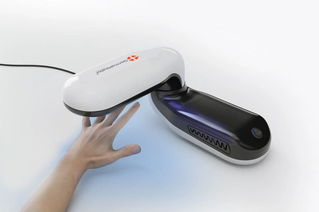 ナローバンドuvb治療器