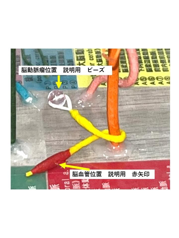 脳血管模型　教育説明用（脳血管模型が必要な人のために）