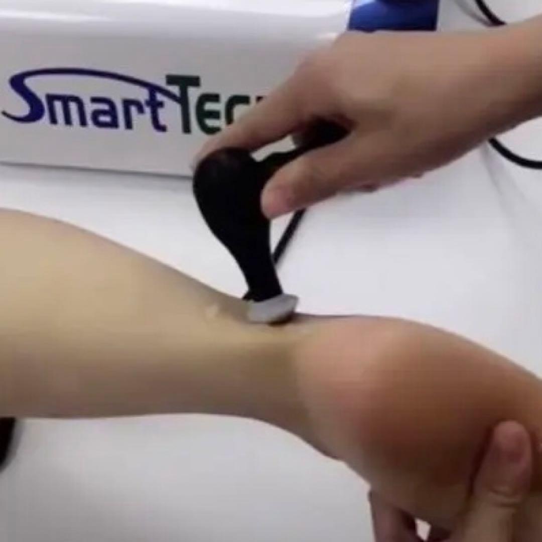 インディバと同じ技術高周波マシン