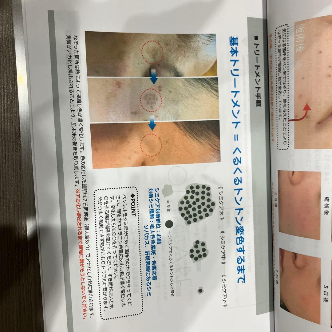 2025年最新式　低周波シミケアマシン　説明書、1年保証付き通電しただけの新品！