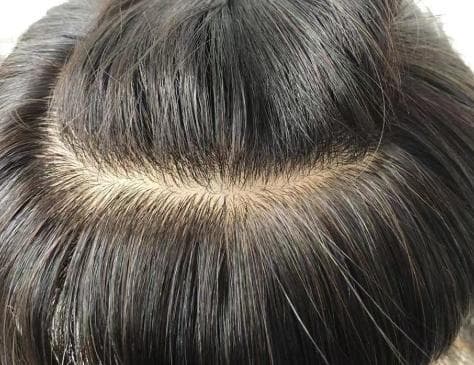 【高品質】人毛 総手植え ウィッグ ミディアム M〜L シルク肌 医療用OK