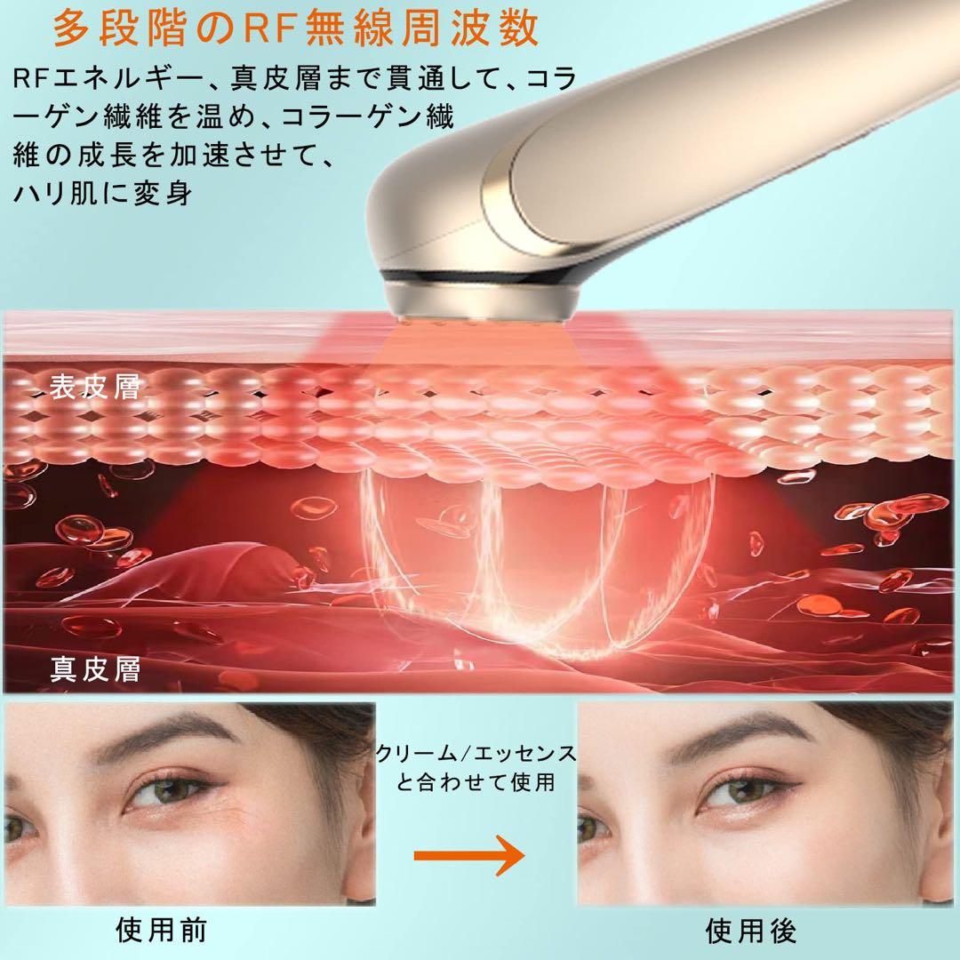美顔器 RF美顔器 イオン導出 イオン導入 EMS 微電流 LED搭載