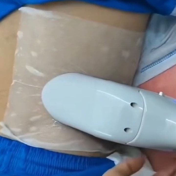 大人気電磁パルスと脂肪冷却が1台にセット！