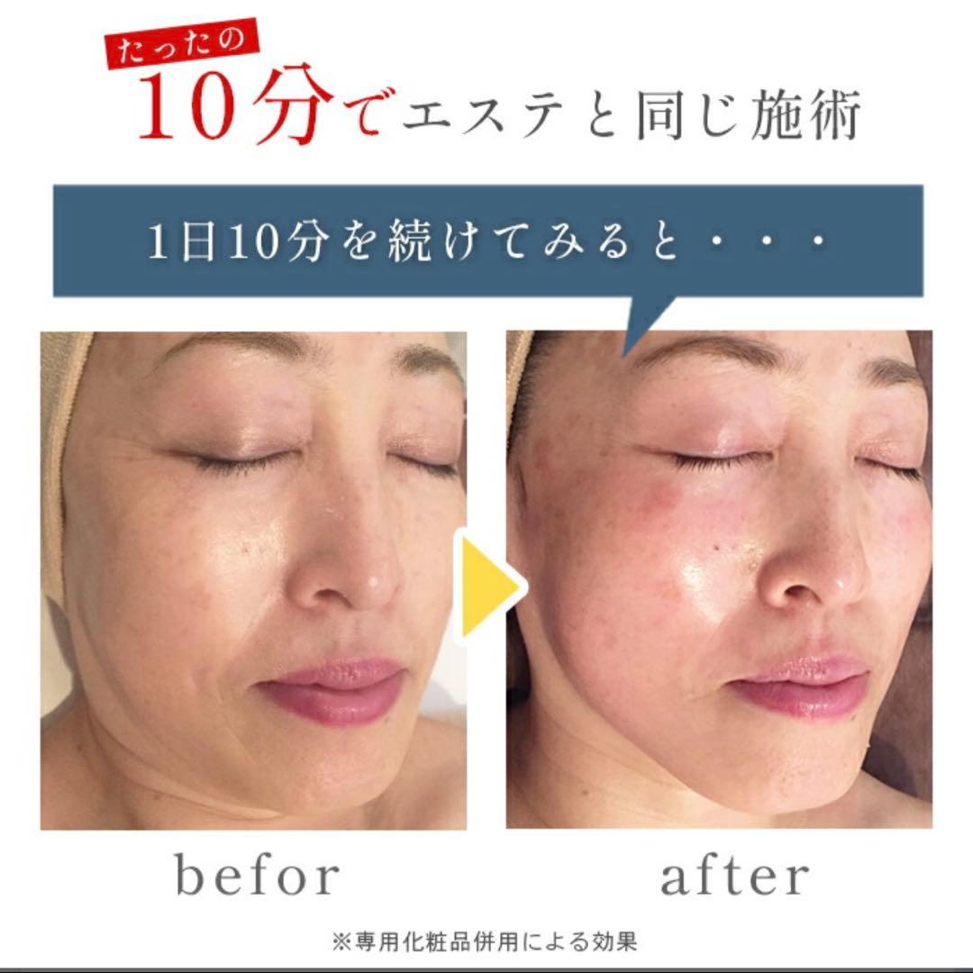 CAVI-R ONE+ PLUS キャビテーション ラジオ波 美顔器