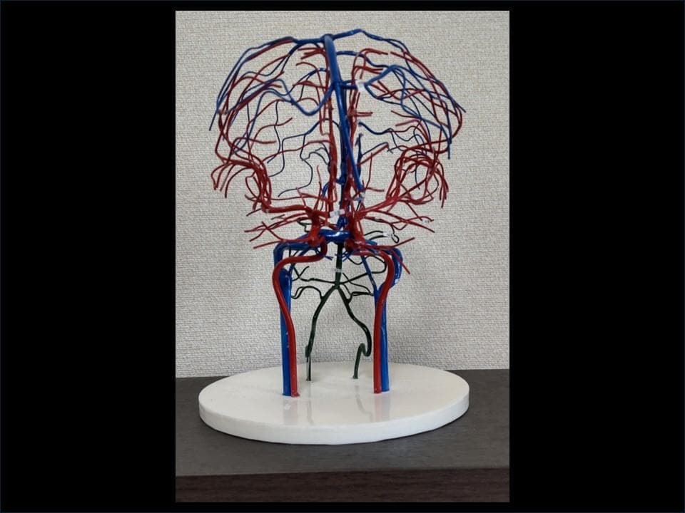 脳血管模型(内頚動脈・椎骨動脈・脳静脈)