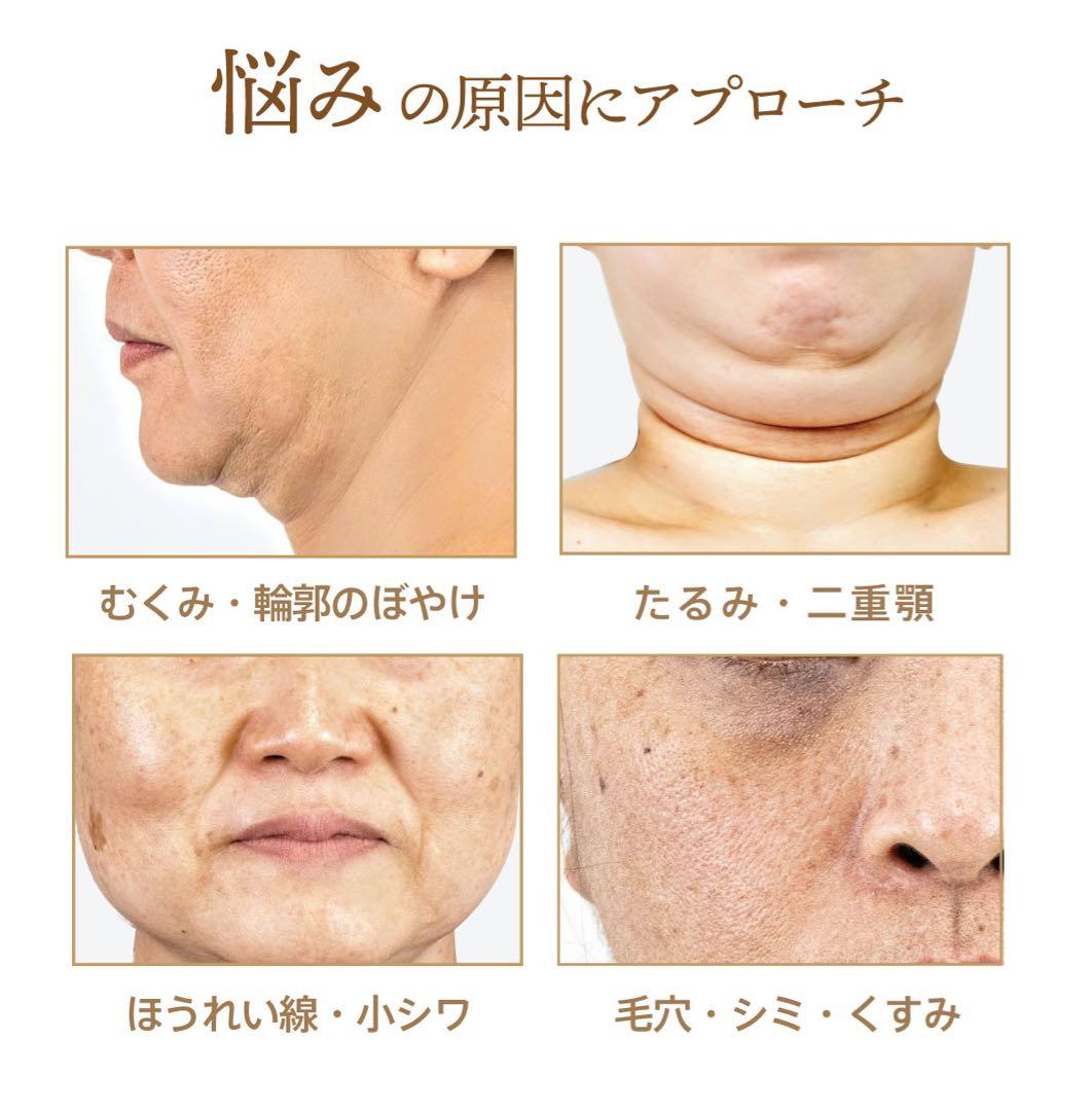 ゾーガンキンブルーム　ZOGANKIN BOOM１万5千以上引　正規　最新美容器