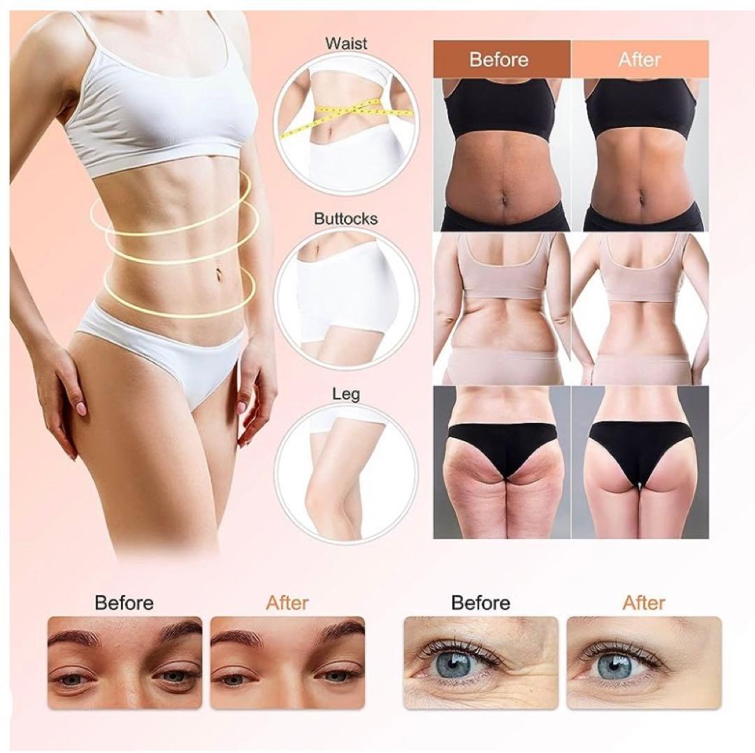 業務用 キャビテーション RF吸引