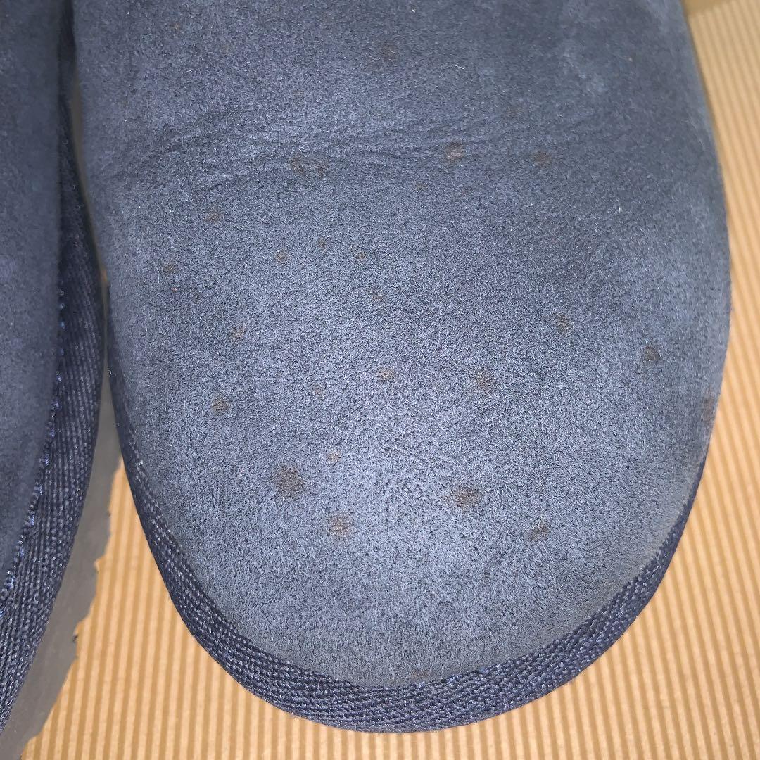 UGG アグ トリプルベイリーボタン・ムートンブーツ