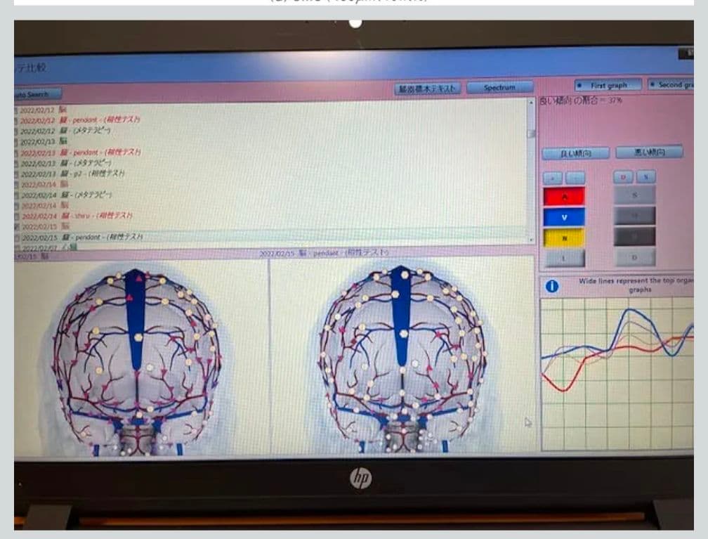 【最終価格】電磁波 防御 cmcbio ペンダント CMC総合研究所