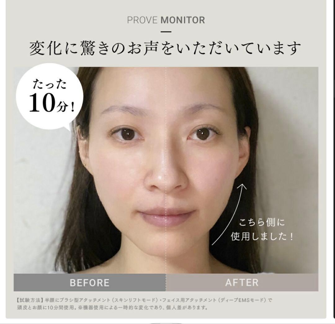 MYTREX 電気バリブラシ、美顔器