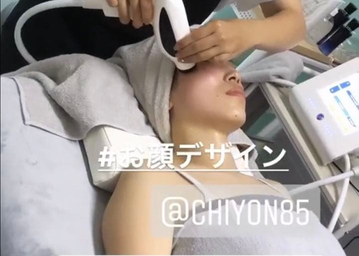 サーマルリフト　S