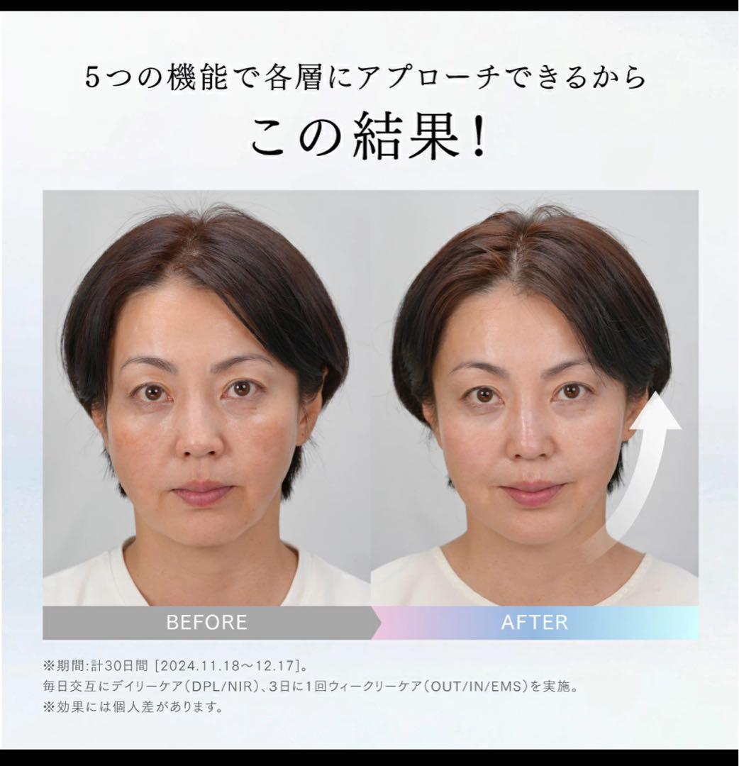 MYTREX MiRAY ONE ブラック 美顔器 リフトアップ