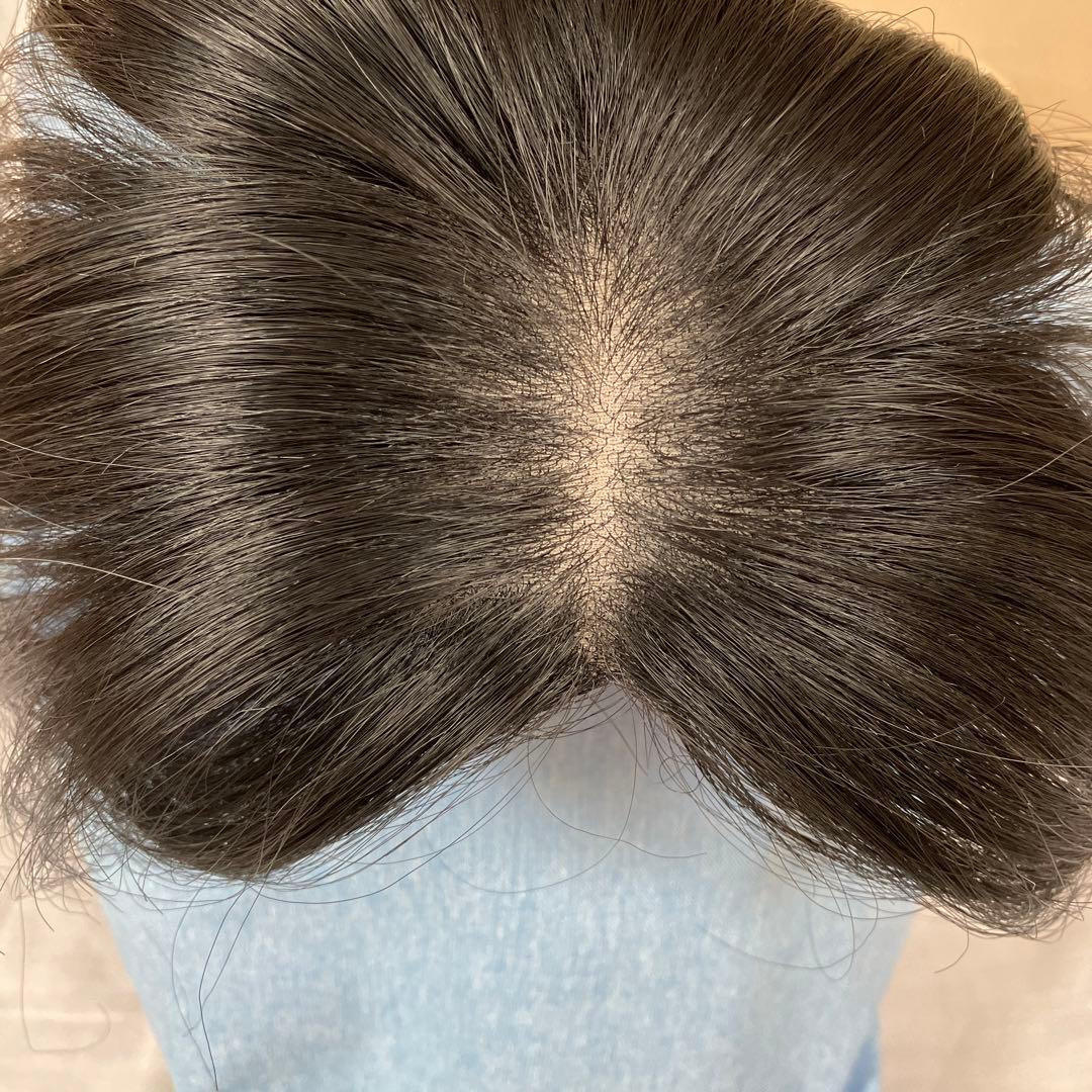 アデランス部分ウィッグ