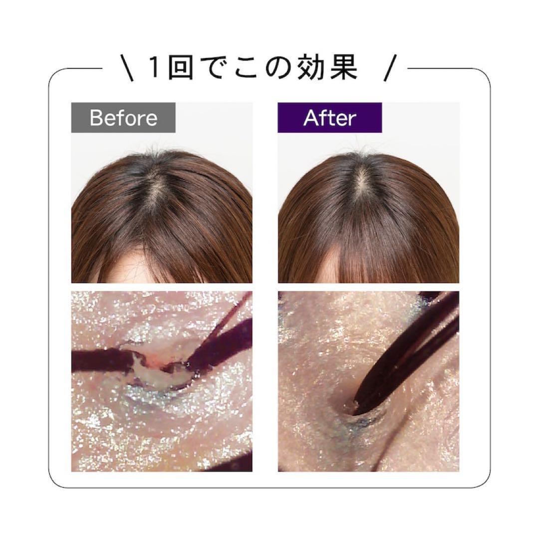 【新品未使用】mysé 美顔器 ホワイト ゴールド 充電器付き