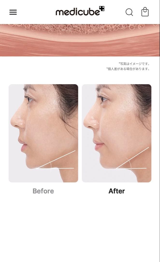 AGE-Rダーマエアショット 美顔器+ミストデバイス