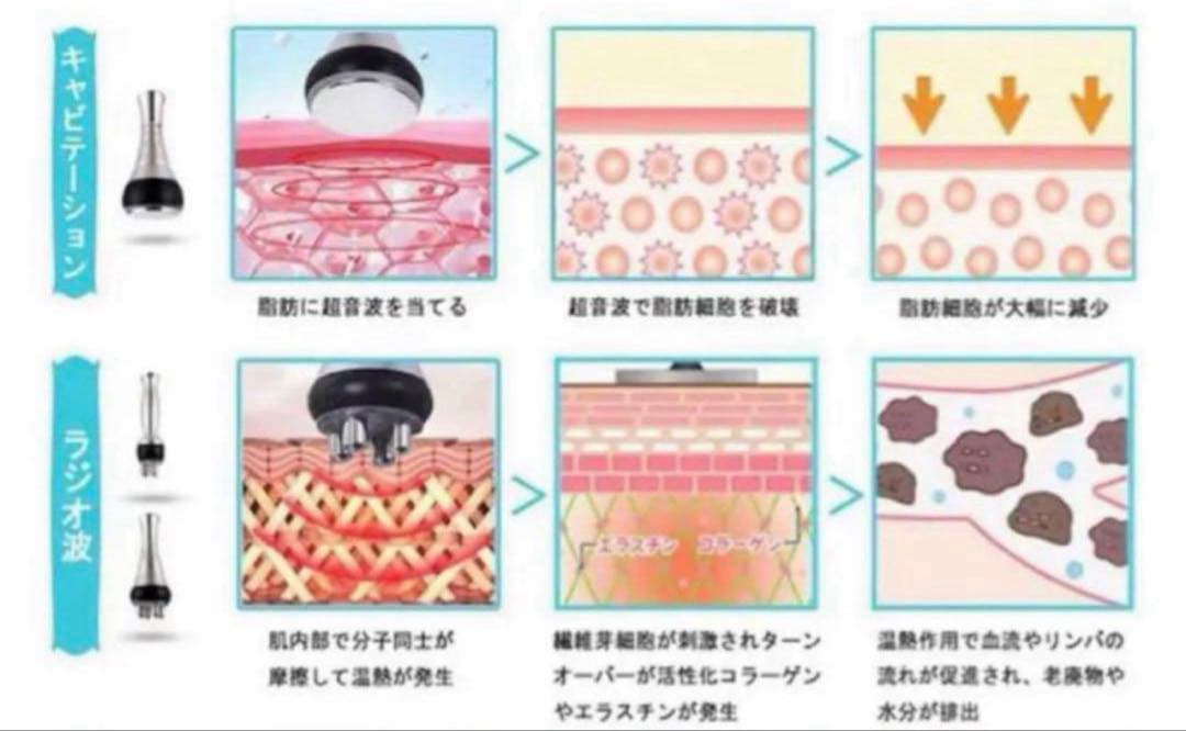 キャビテーション　ラジオ波　エステ