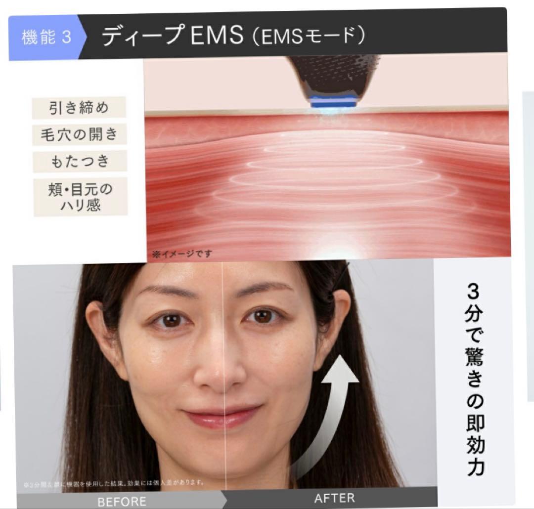 MYTREX ミライワン ホワイト 【保証番号有り】保湿美容ゲル付き