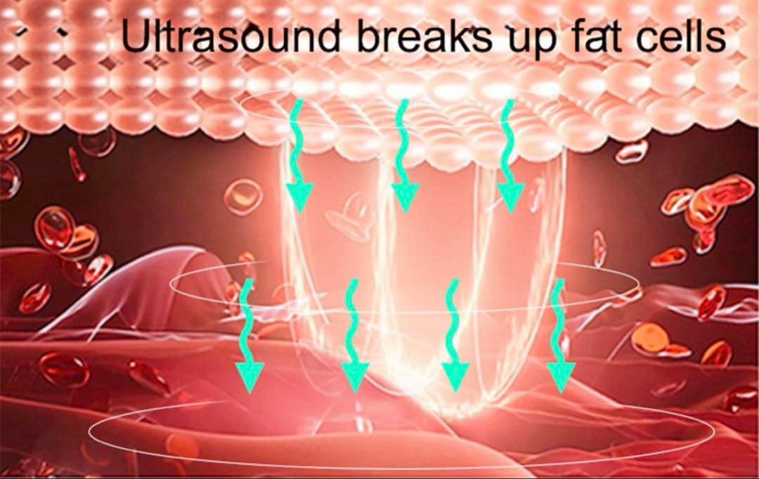 4in1業務用/家庭用キャビテーション40Khz/痩身/肌引き締め/脂肪吸引
